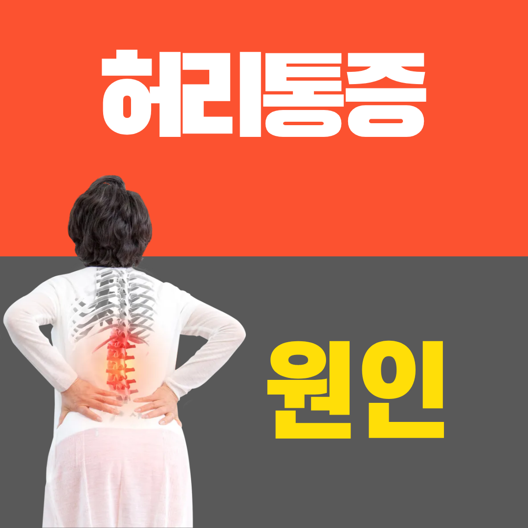 허리통증원인